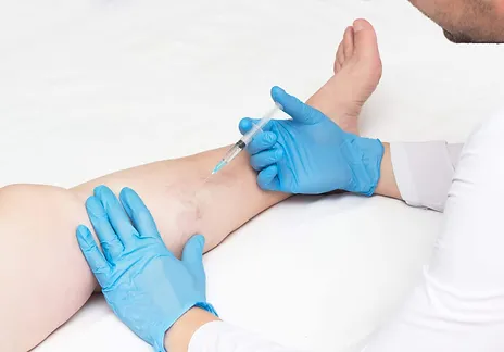 Sclerotherapy Johnson City TN
