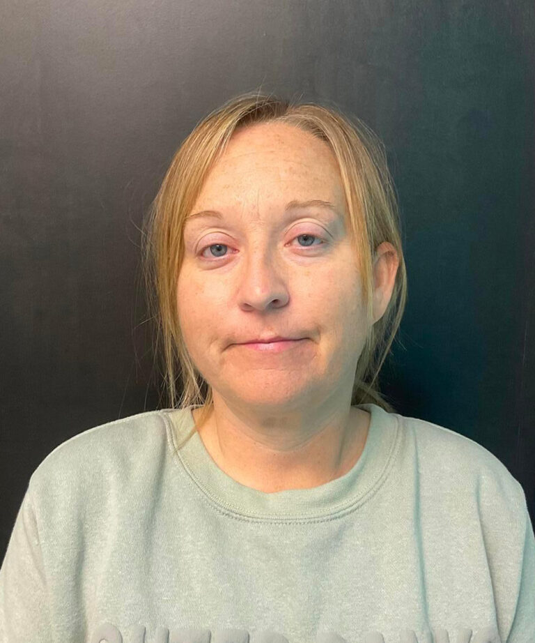 Before Image: Lumecca IPL - front